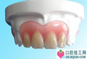 隐形牙